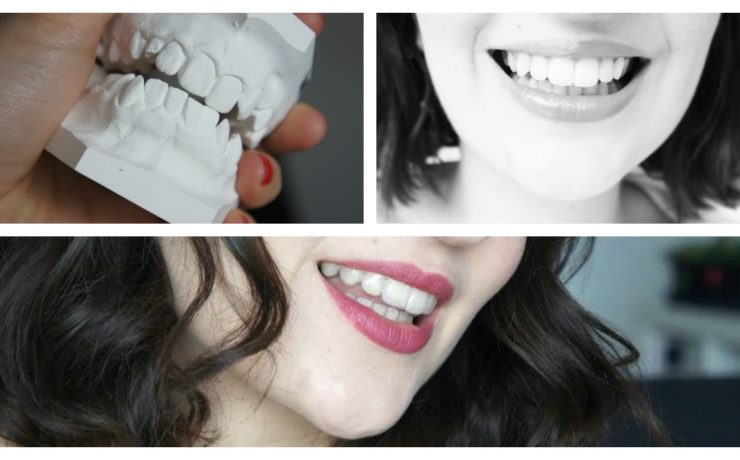 Orthodontie et douleur