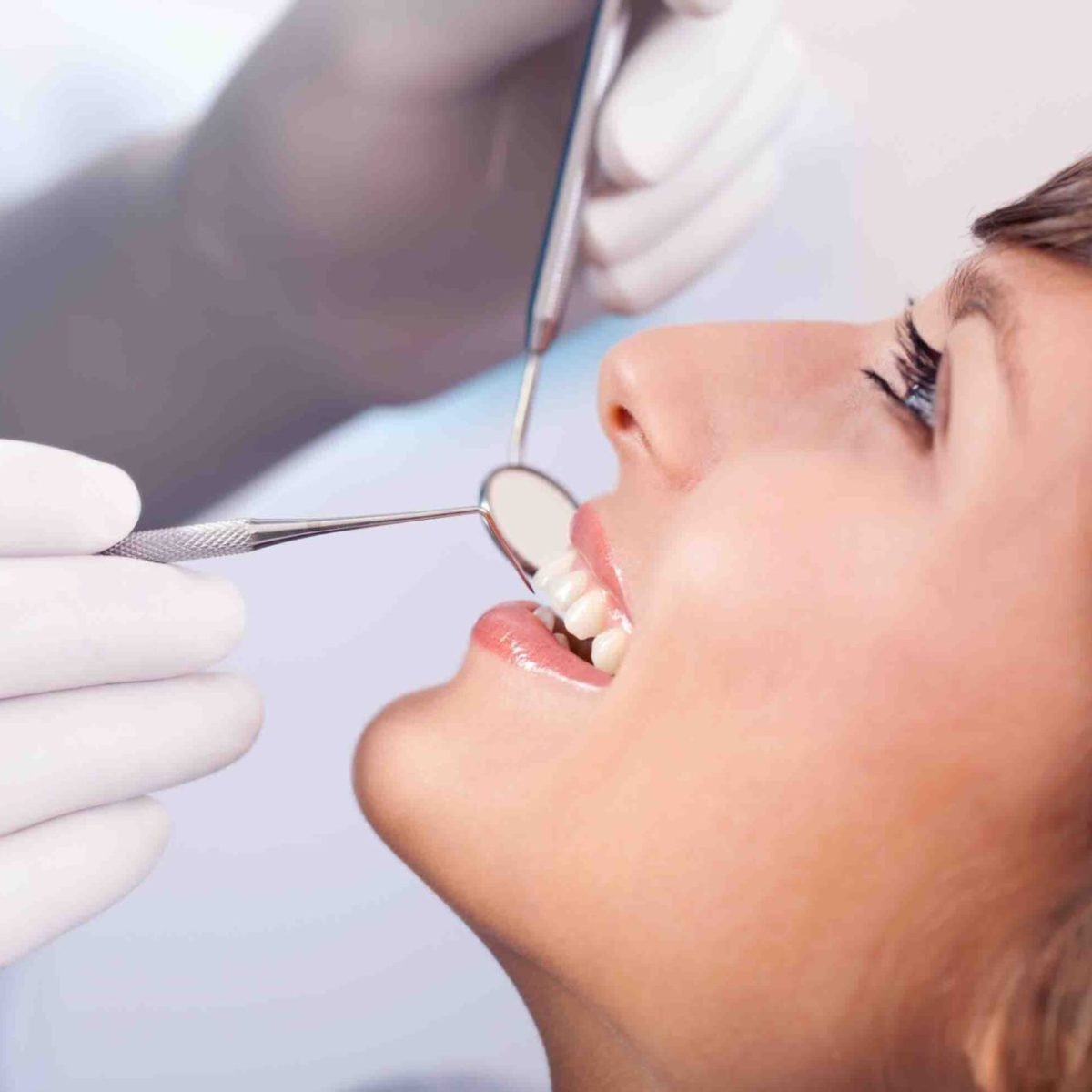 Détratrage des dents
