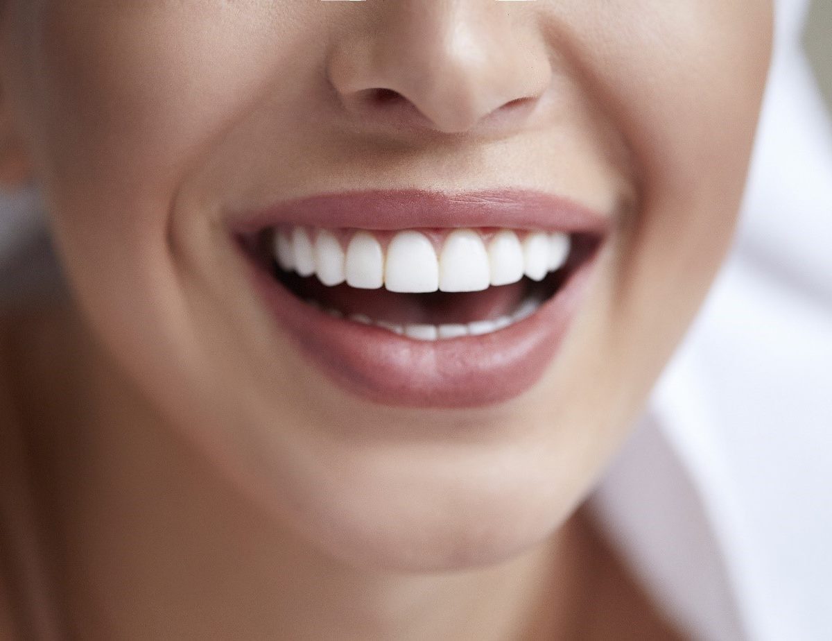 Des solutions pour avoir de belles dents