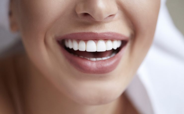 Des solutions pour avoir de belles dents