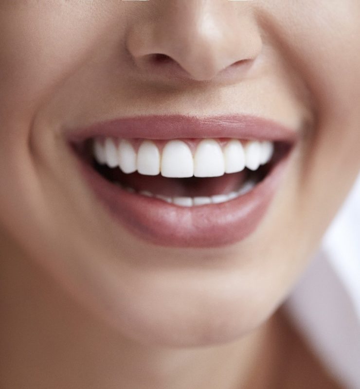 Des solutions pour avoir de belles dents