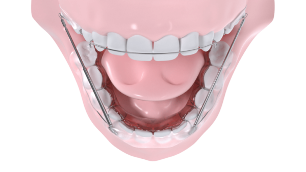 Activateur de croissance mandibulaire