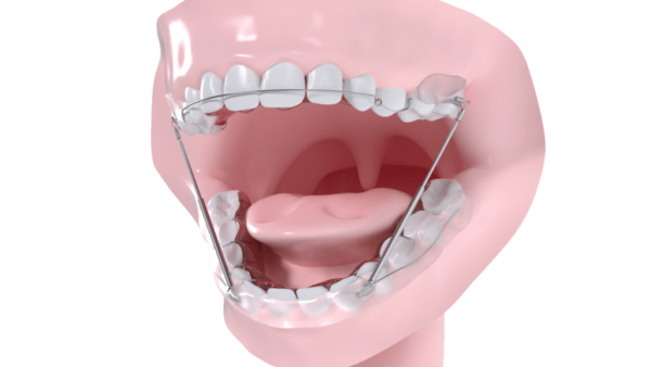 Activateur de croissance mandibulaire