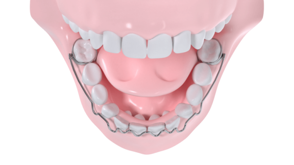 ODF, l'orthopédie dento-faciale