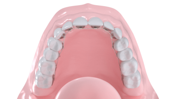 multibague lingual suisse canton de vaud